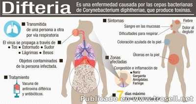 #ALERTA #SALUD Descubre que es la #Difteria sus síntomas y prevención